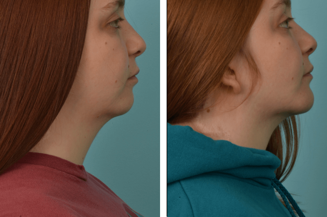 3D_C67_KJ_Profile