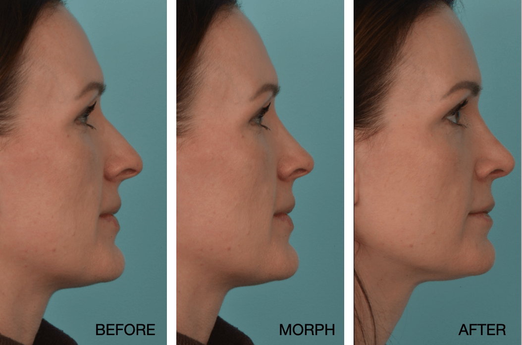 Heidi Lowder_Rhino_Morph