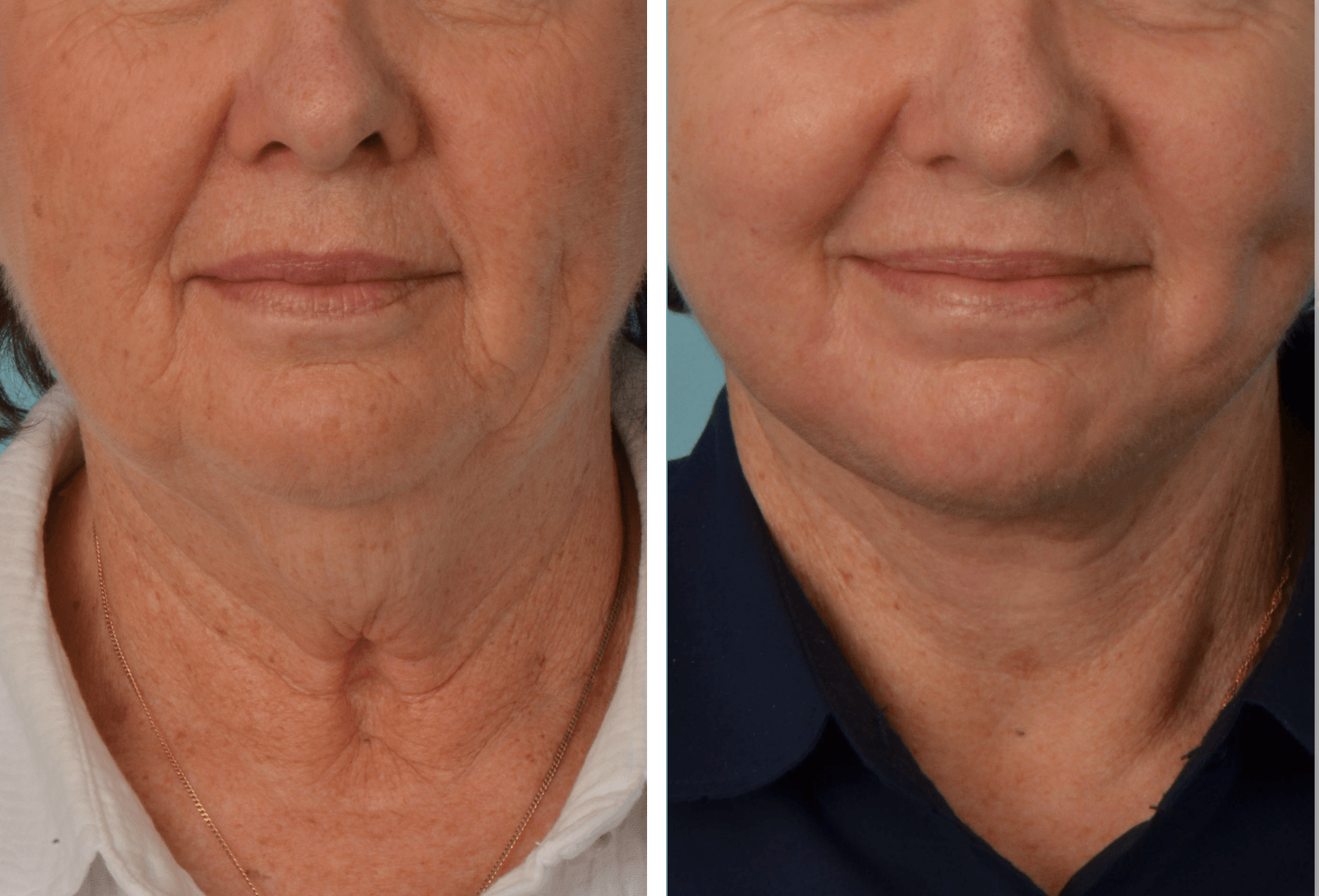 Shauna_Hepworth_Nec:Face_Frontal